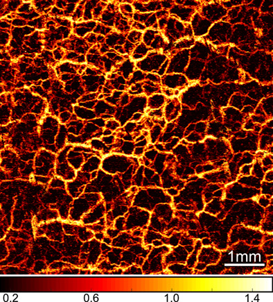 Jones matrix-based speckle-decorrelation angiography using polarization-sensitive optical coherence tomography