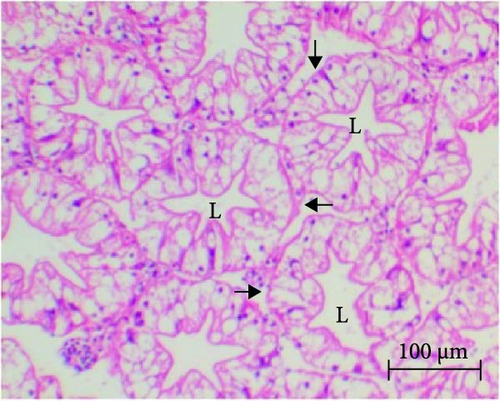 Details are in the caption following the image