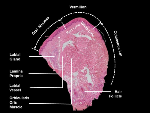 Details are in the caption following the image Details are in the caption following the image