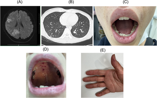 Details are in the caption following the image Details are in the caption following the image