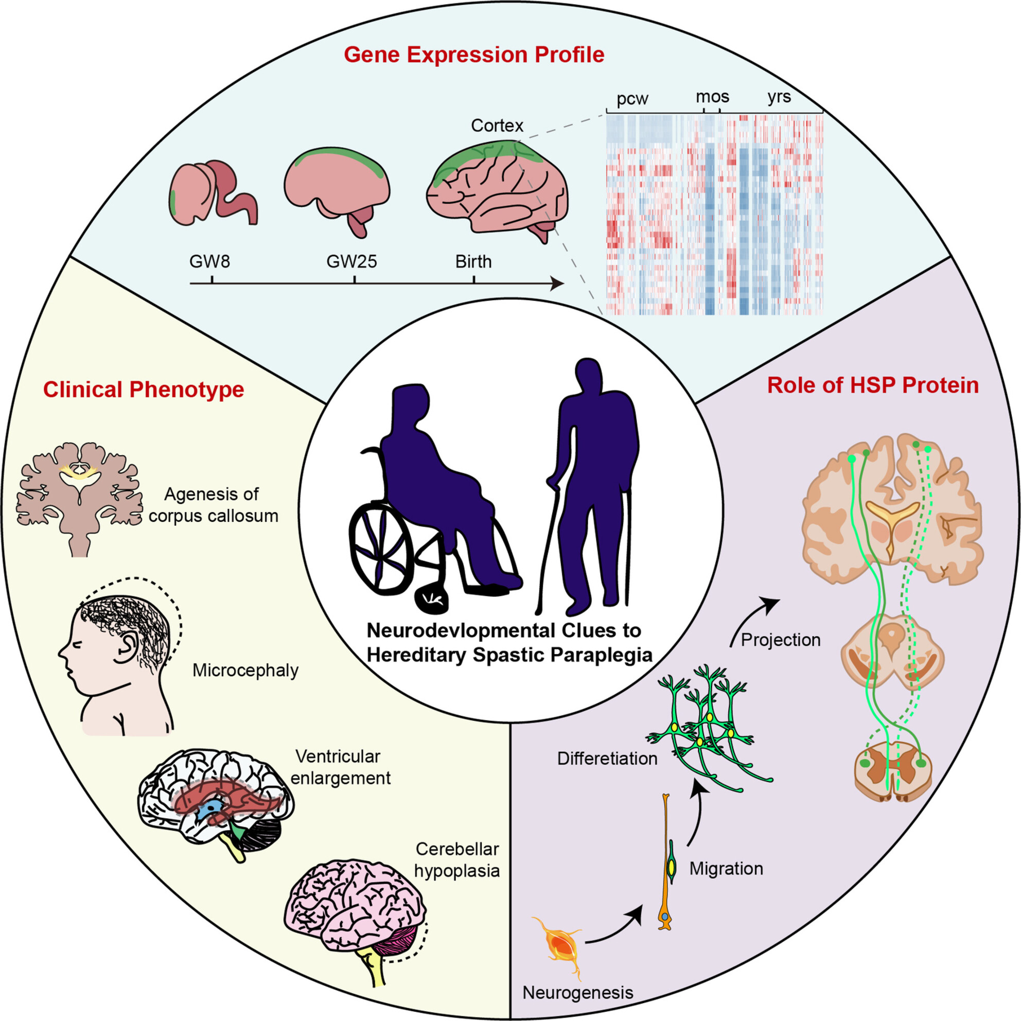 Neurodevelopmental Implications Underpinning Hereditary Spastic Paraplegia