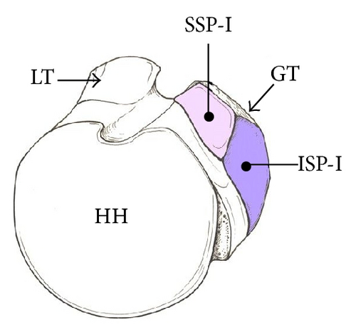 Details are in the caption following the image