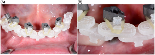 Details are in the caption following the image Details are in the caption following the image