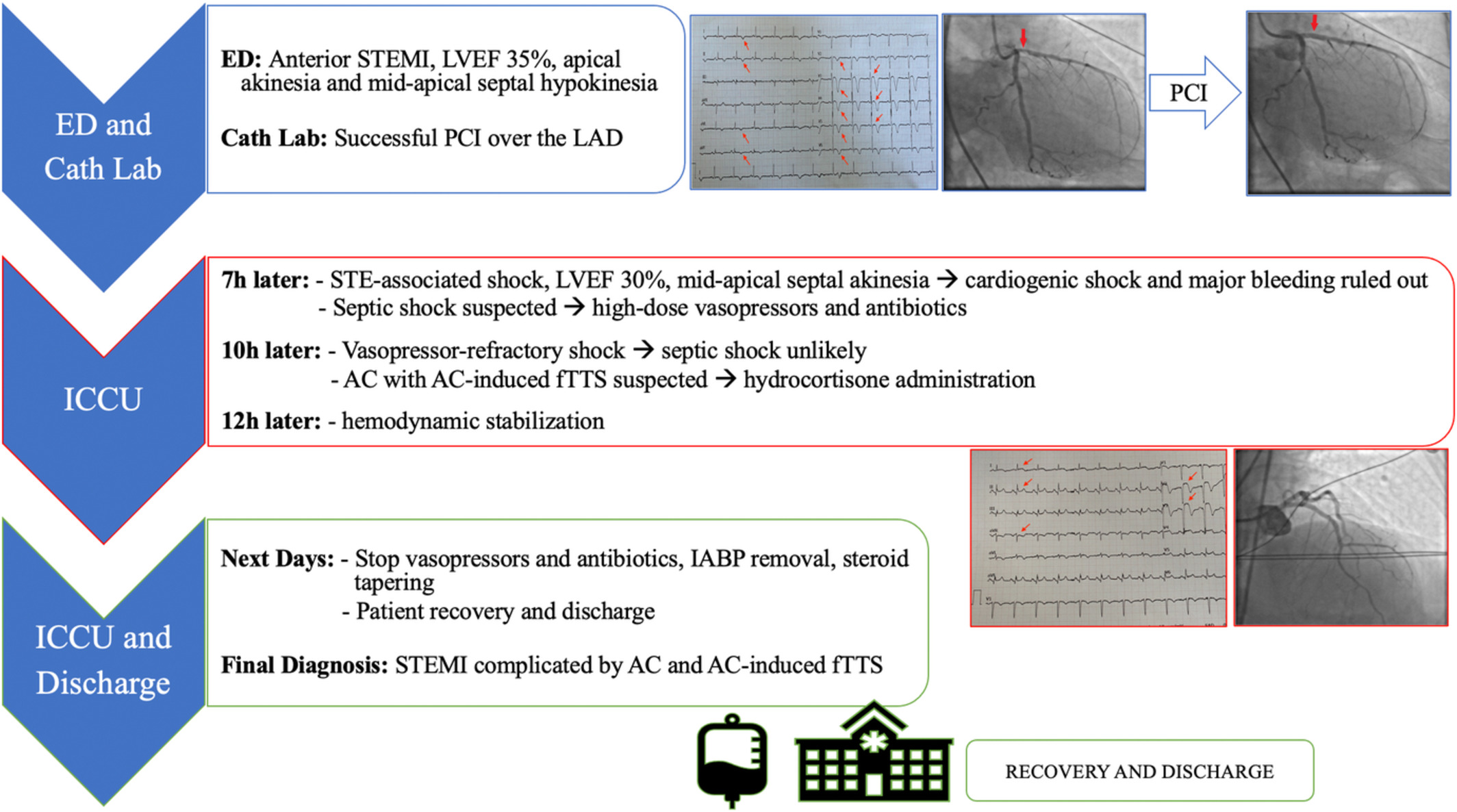 A case of shock after STEMI: Think beyond the cardiogenic one