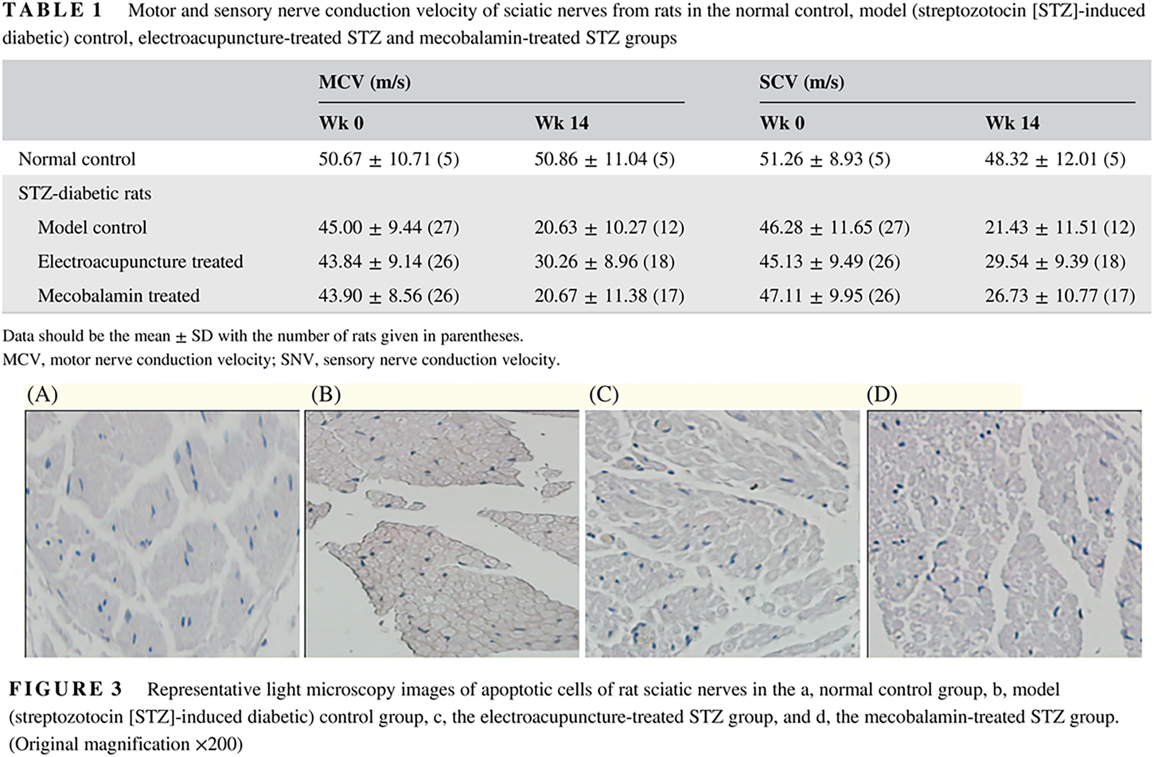 “Adjusting internal organs and dredging channel” electroacupuncture treatment prevents the development of diabetic peripheral neuropathy by downregulating glucose-related protein 78 (GRP78) and caspase-12 in streptozotocin-diabetic rats “调脏通络”电针疗法通过下调链脲佐菌素诱导的糖尿病大鼠的GRP78和 caspase-12水平阻止糖尿病周围神经病变的发展