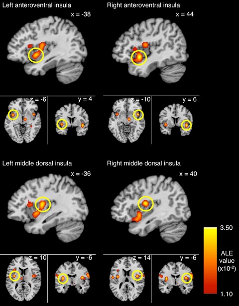 Basic taste processing recruits bilateral anteroventral and middle dorsal insulae: An activation likelihood estimation meta-analysis of fMRI studies