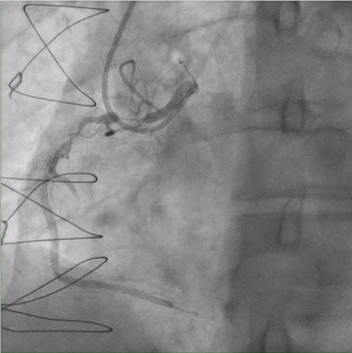 Details are in the caption following the image