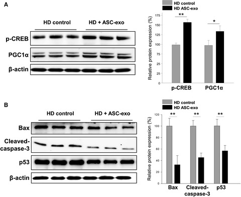 Exosomes from adipose-derived stem cells ameliorate phenotype of Huntington's disease in vitro model