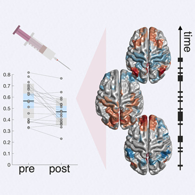 Dynamic functional networks in idiopathic normal pressure hydrocephalus: Alterations and reversibility by CSF tap test