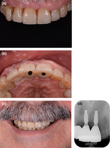 Details are in the caption following the image Details are in the caption following the image