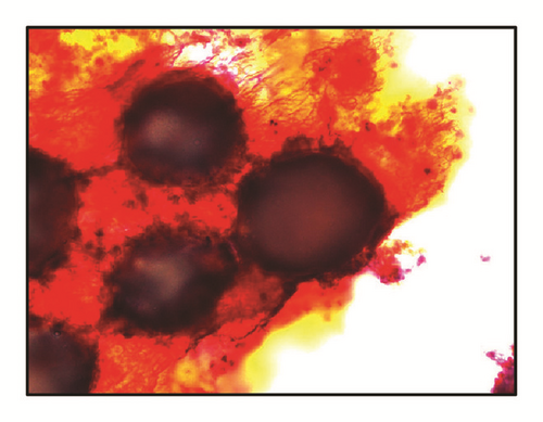 Details are in the caption following the image