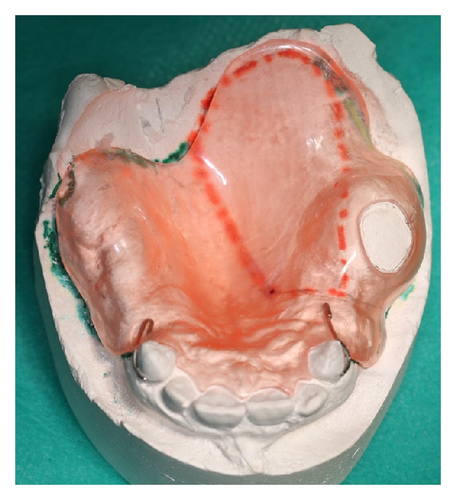 Details are in the caption following the image Details are in the caption following the image