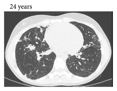 Details are in the caption following the image