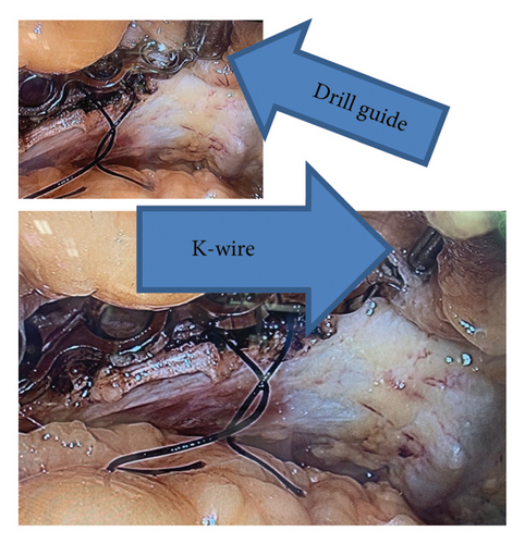 Details are in the caption following the image Details are in the caption following the image