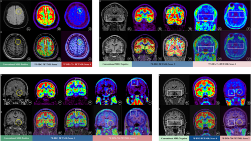 Details are in the caption following the image Details are in the caption following the image