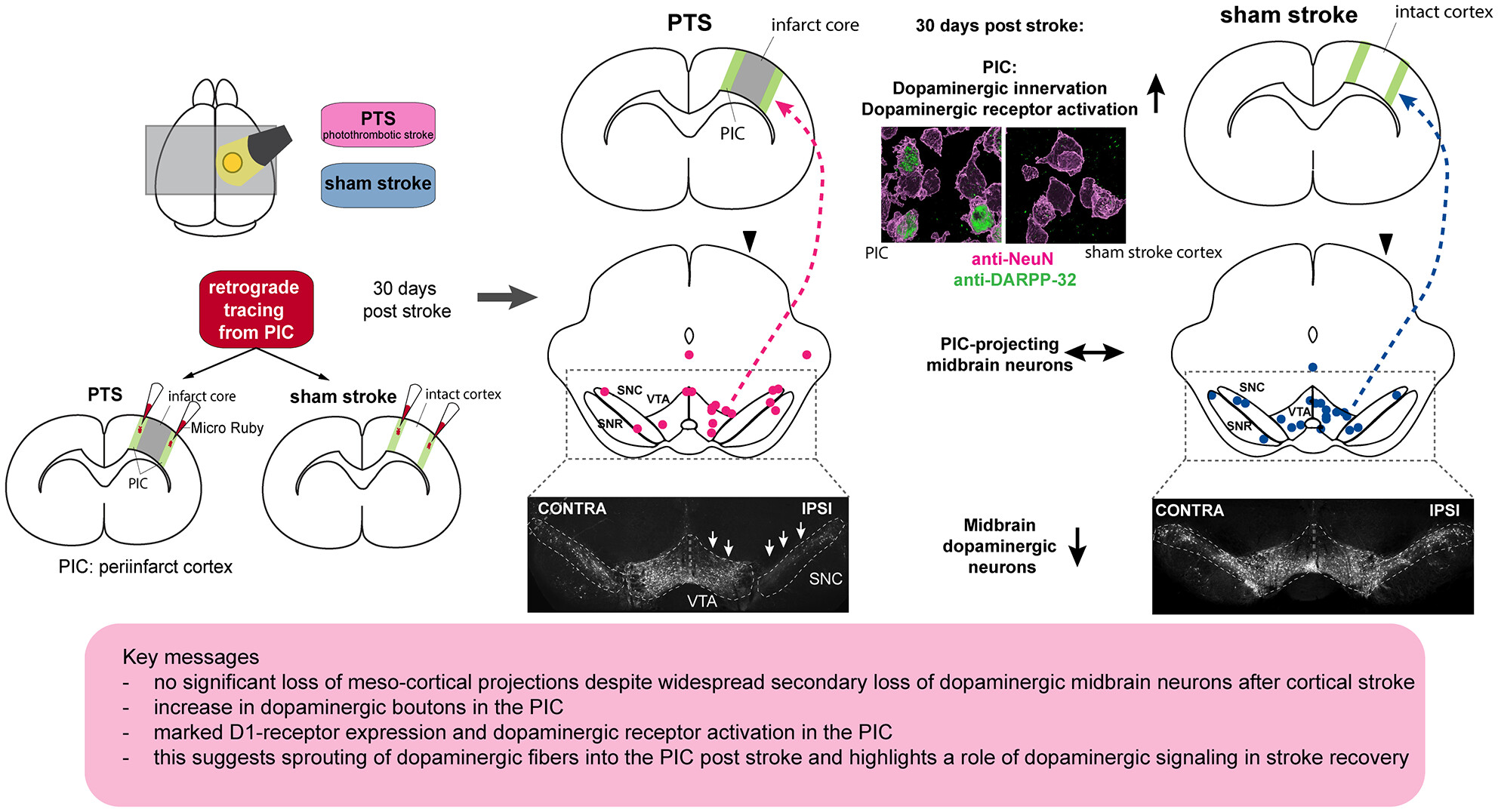 Dense dopaminergic innervation of the peri-infarct cortex despite dopaminergic cell loss after a pure motor-cortical stroke in rats