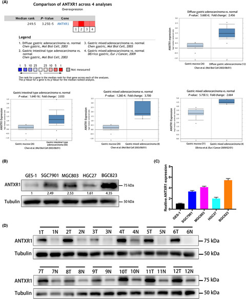 Anthrax toxin receptor 1/tumor endothelial marker 8 promotes gastric cancer progression through activation of the PI3K/AKT/mTOR signaling pathway