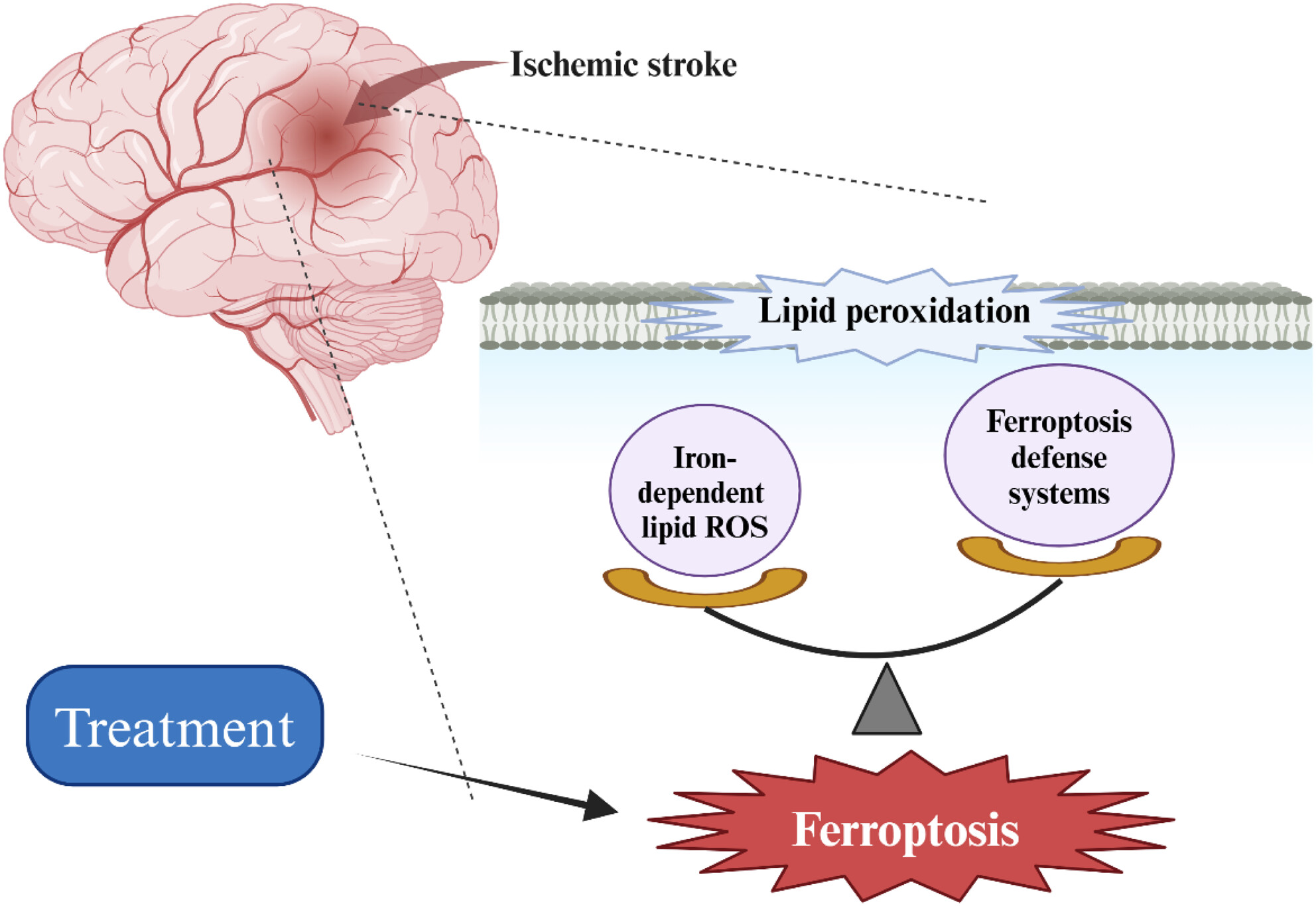 Mechanism of ferroptosis regulating ischemic stroke and pharmacologically inhibiting ferroptosis in treatment of ischemic stroke