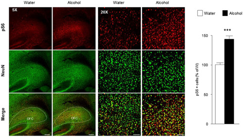 Region specific activation of the AKT and mTORC1 pathway in response to excessive alcohol intake in rodents