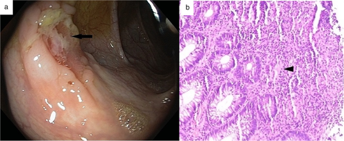 Details are in the caption following the image Details are in the caption following the image