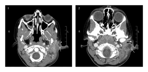 Details are in the caption following the image Details are in the caption following the image