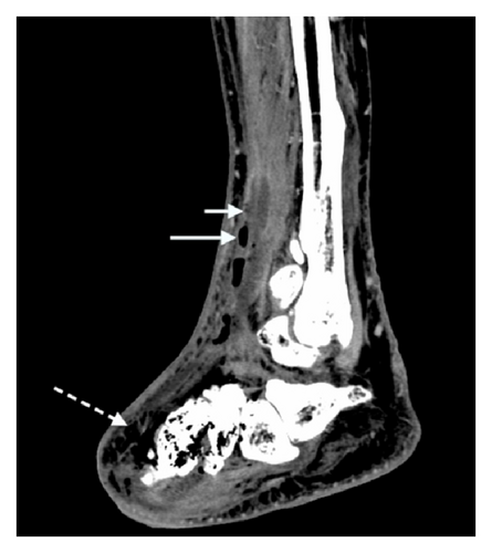 Details are in the caption following the image