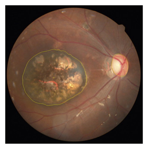 Details are in the caption following the image Details are in the caption following the image