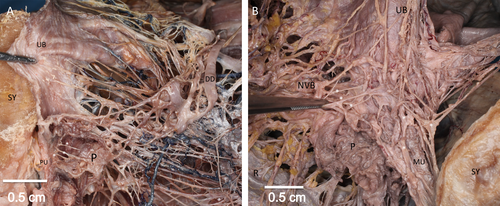 Details are in the caption following the image