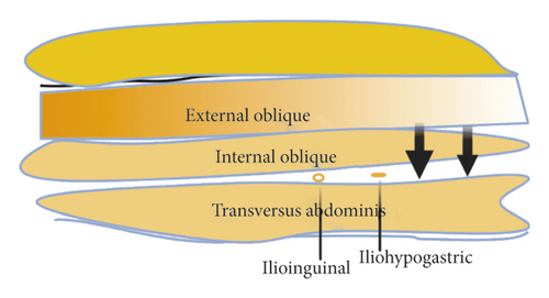 Details are in the caption following the image