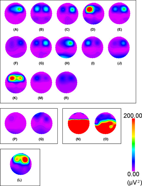 Characteristics of facial muscle activity during voluntary facial expressions: Imaging analysis of facial expressions based on myogenic potential data