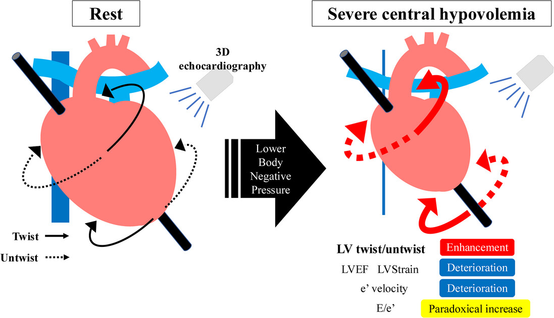 Changes in Left Ventricular Function Assessed by 3D Echocardiography During Severe Central Hypovolemia in Healthy Humans