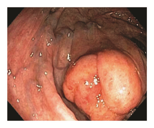 Details are in the caption following the image Details are in the caption following the image