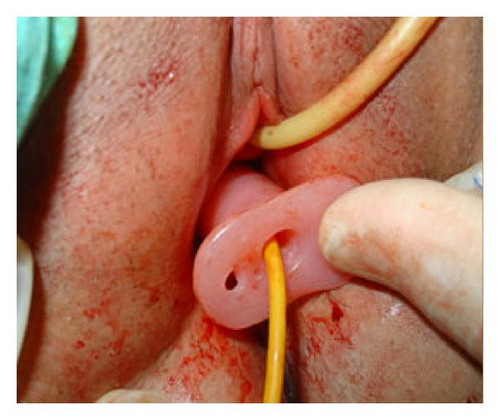 Details are in the caption following the image Details are in the caption following the image