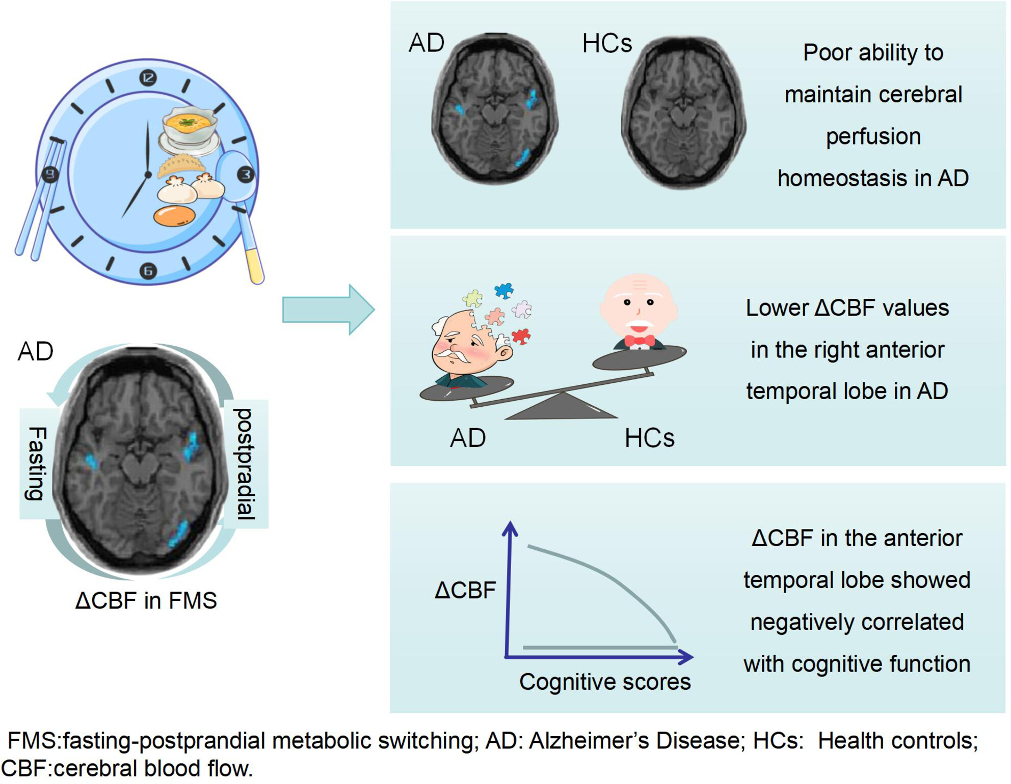 Neuroimaging analysis reveals distinct cerebral perfusion responses to fasting-postprandial metabolic switching in Alzheimer's disease patients