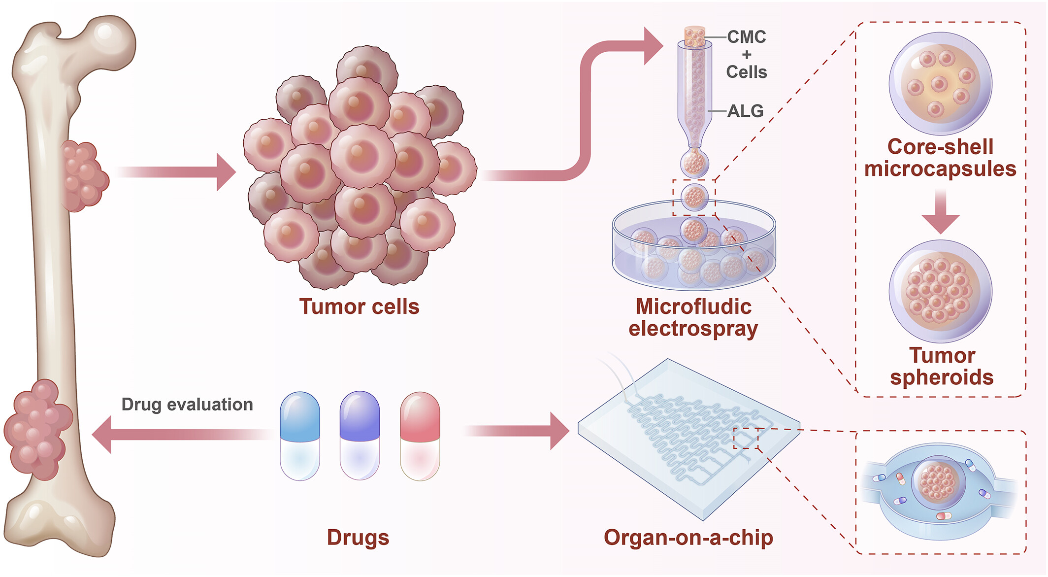 Permeable Hydrogel Encapsulated Osteosarcoma-on-a-Chip for High-Throughput Multi-Drugs Screening