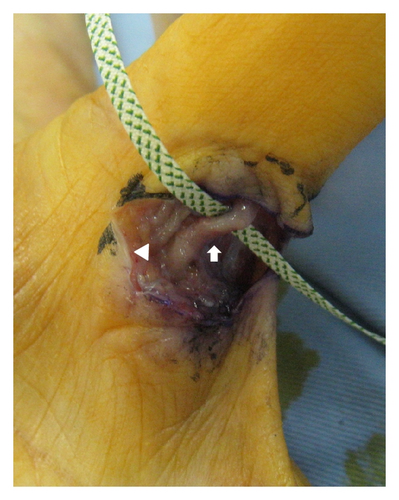 Details are in the caption following the image Details are in the caption following the image