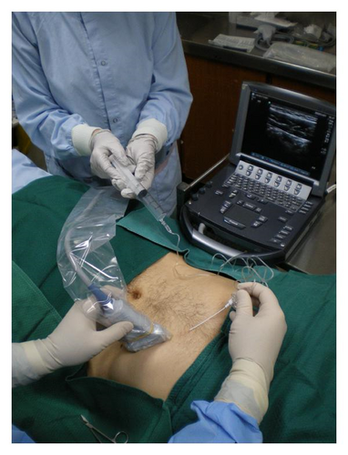 Details are in the caption following the image