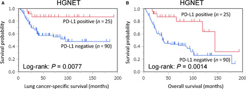 Relationship of tumor PD-L1 (CD274) expression with lower mortality in lung high-grade neuroendocrine tumor