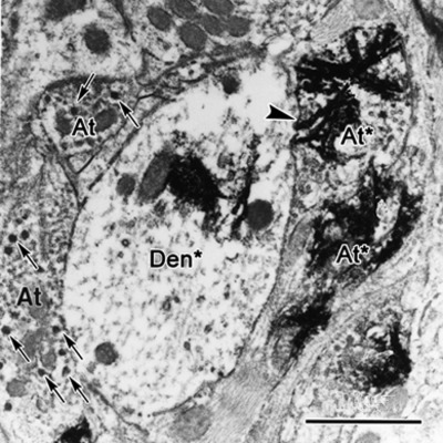 Central pupillary light reflex circuits in the cat: I. The olivary pretectal nucleus