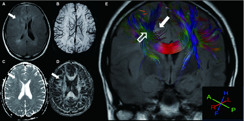 Details are in the caption following the image Details are in the caption following the image