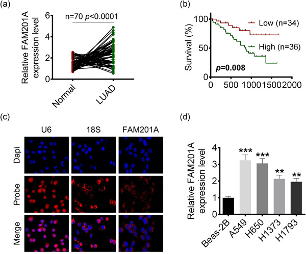 FAM201A knockdown inhibits proliferation and invasion of lung adenocarcinoma cells by regulating miR-7515/GLO1 axis