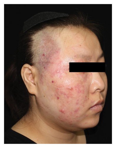 Details are in the caption following the image Details are in the caption following the image