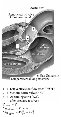 Details are in the caption following the image