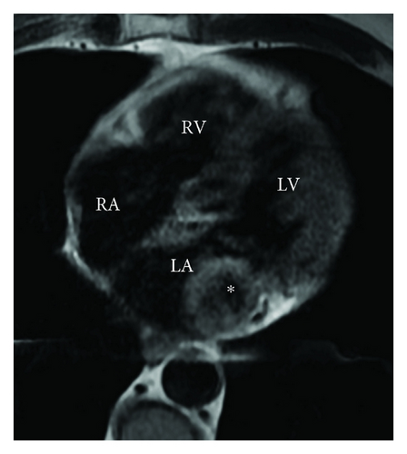 Details are in the caption following the image