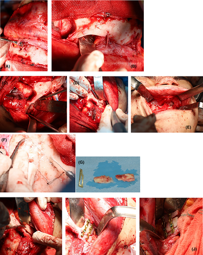 Details are in the caption following the image Details are in the caption following the image