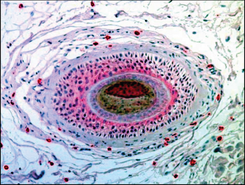 Details are in the caption following the image