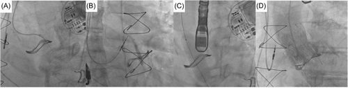 Details are in the caption following the image Details are in the caption following the image