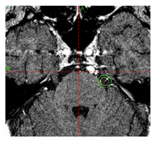 Details are in the caption following the image