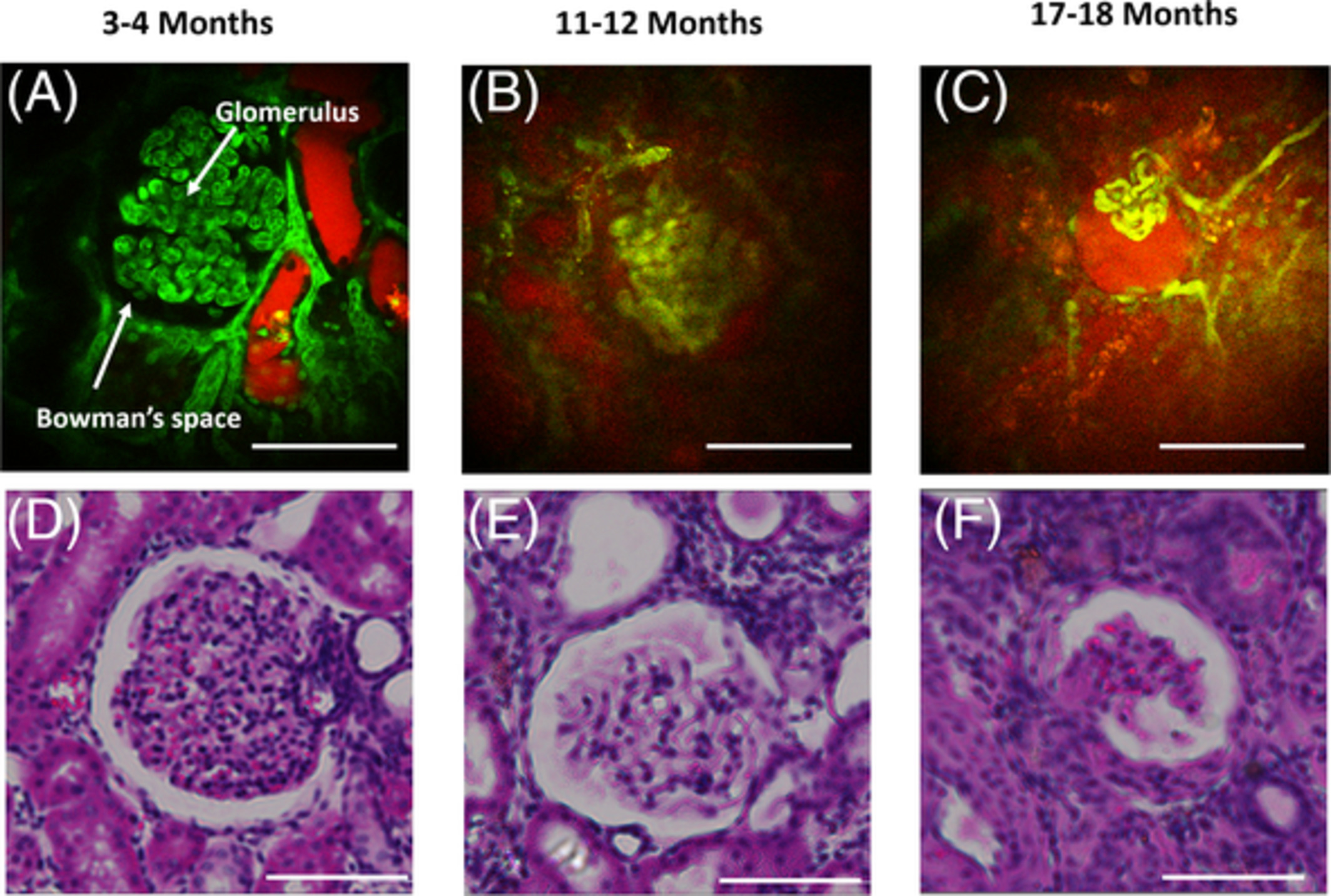 Morphological and functional characteristics of aging kidneys based on two-photon microscopy in vivo