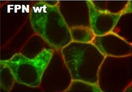 Ferroportin Diseases: Functional Studies, a Link Between Genetic and Clinical Phenotype